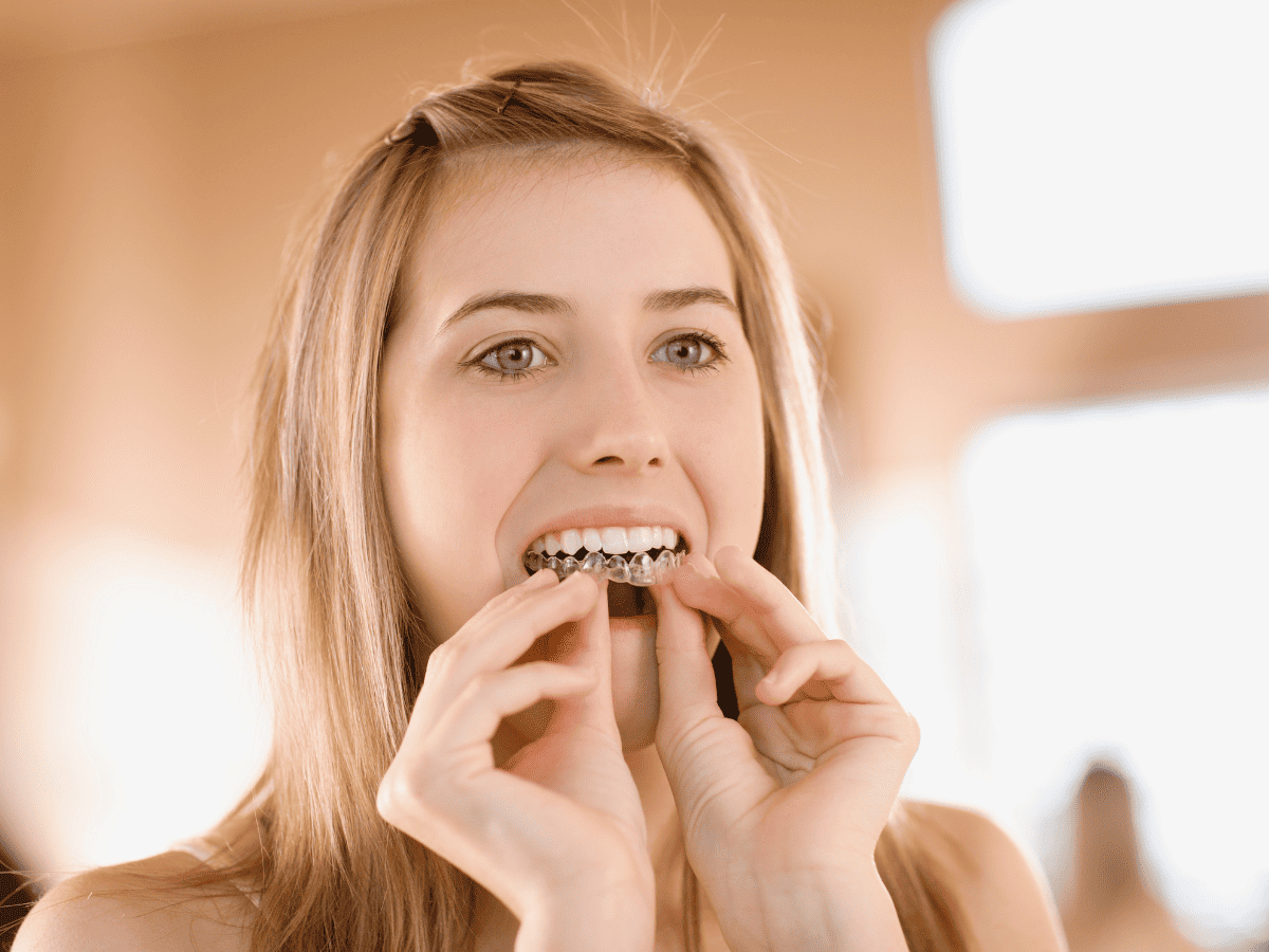 teenager whitening teeth | Fit Fun And Over 40 teenager whitening teeth